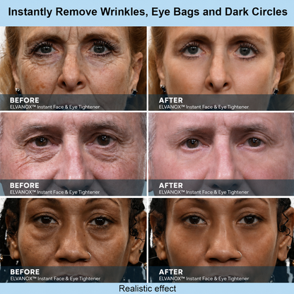 ELVANOX™ Instant Face Temporary Tightener – Instant visible results in 60 seconds