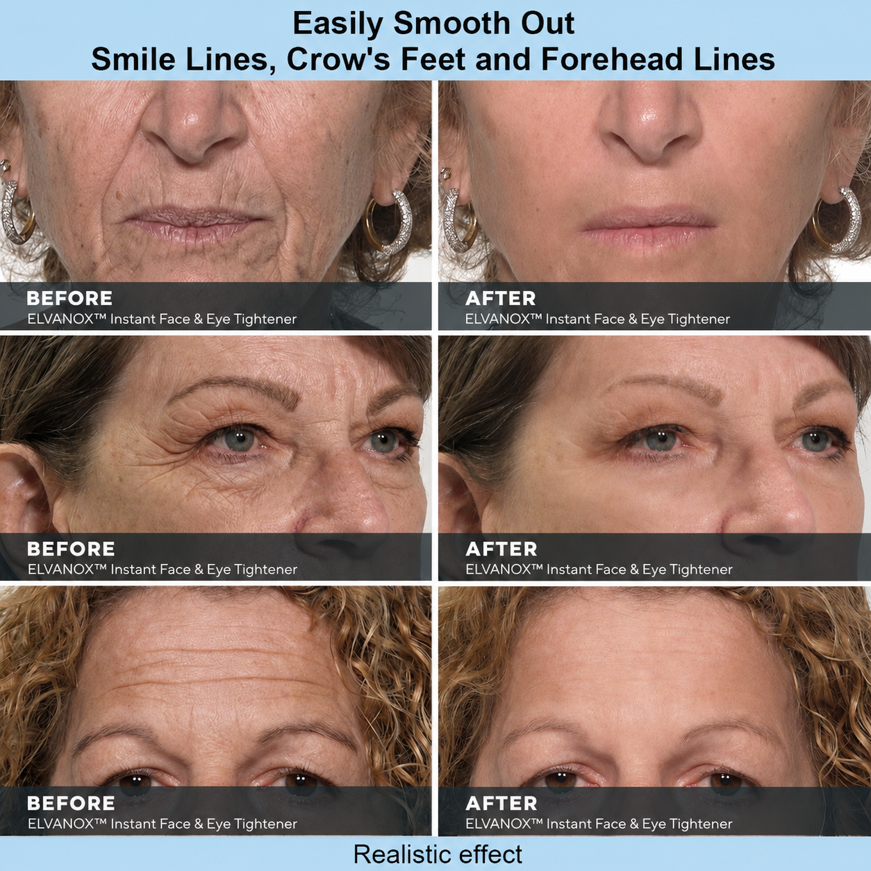 ELVANOX™ Instant Face Temporary Tightener – Instant visible results in 60 seconds